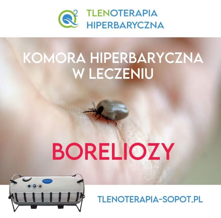 Read more about the article Wpływ sesji w komorze hiperbarycznej na boreliozę
