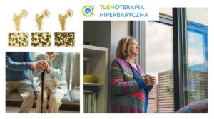 Read more about the article Tlenoterapia hiperbaryczna w walce z osteoporozą