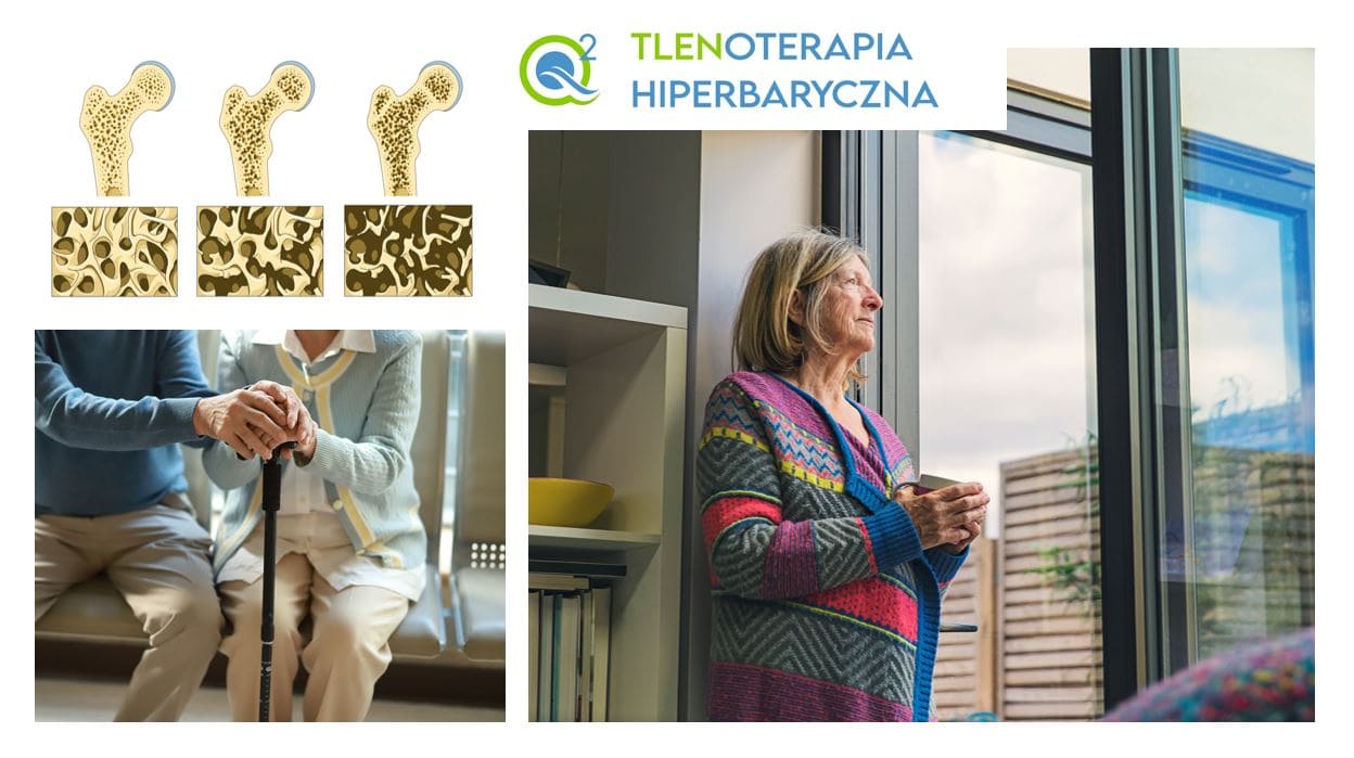 Read more about the article Tlenoterapia hiperbaryczna w walce z osteoporozą